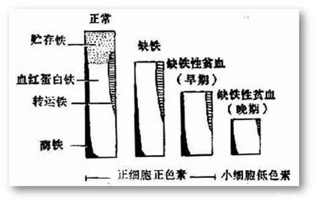 缺铁性贫血如何吃才能“补铁”？