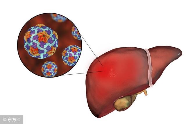 慢性肝炎患者如何吃？佑安营养师来支招